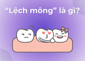 Lệch mông là gì?