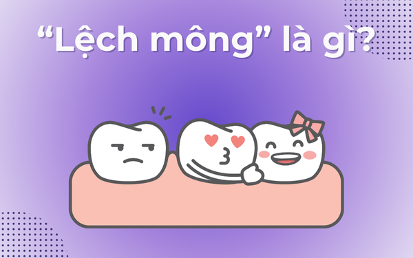 Lệch mông là gì?
